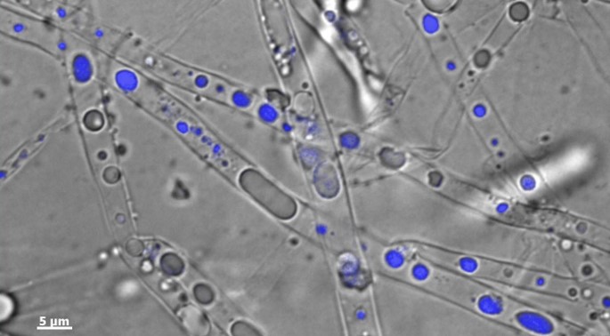 'Fungal pipeline' - Hyphae promote contaminant bioavailability by uptake, cytoplasmic streaming and release of phenanthrene (in blue)
(&copy; Susan Fo&szlig;/UFZ)